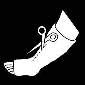 broken leg